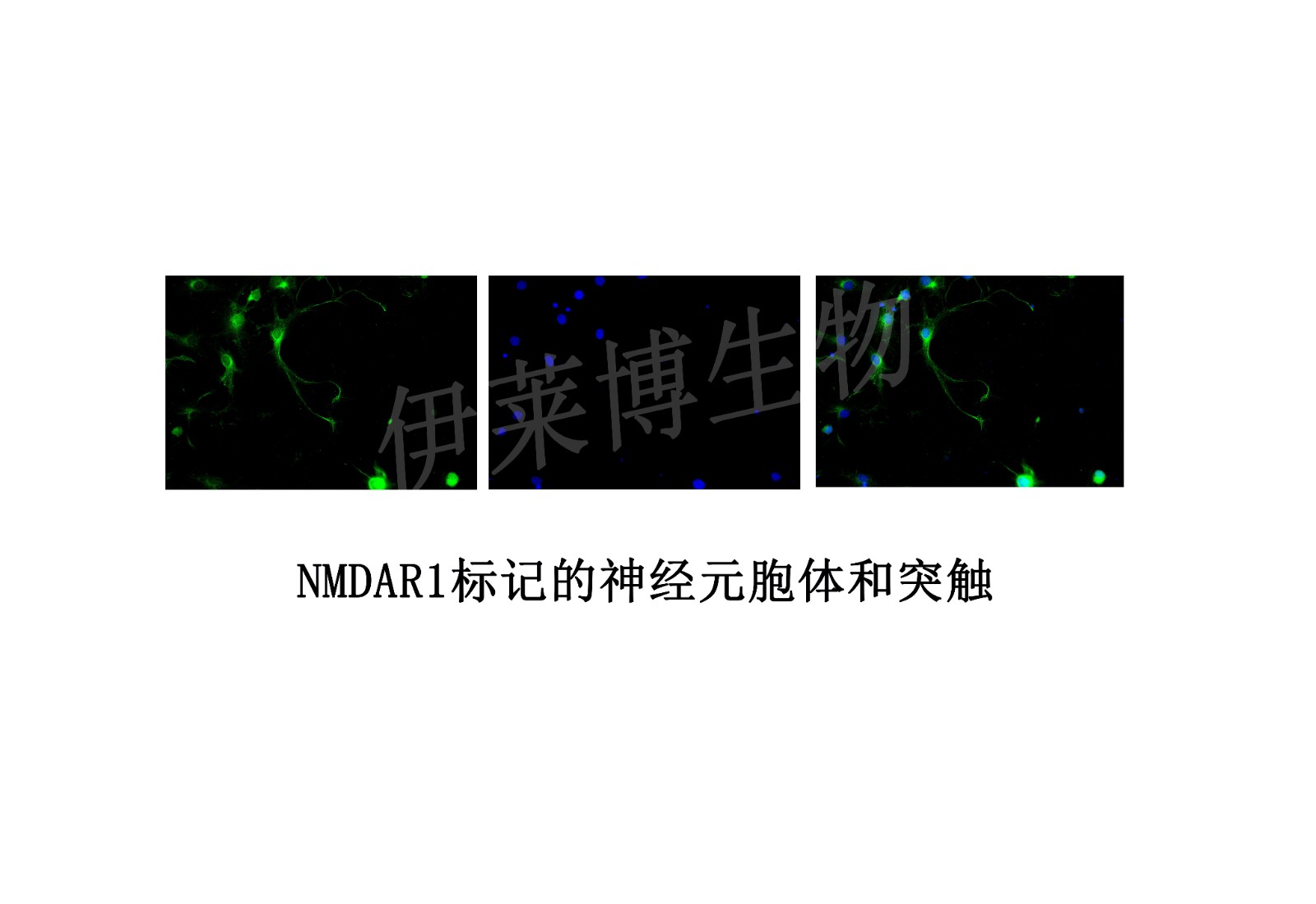 NMDAR1標(biāo)記的神經(jīng)元胞體和突觸.jpg